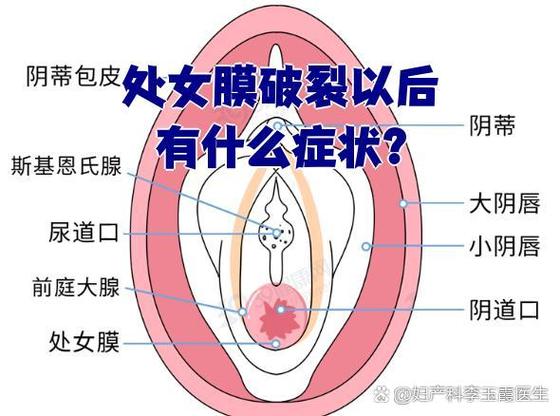 处女有什么表现