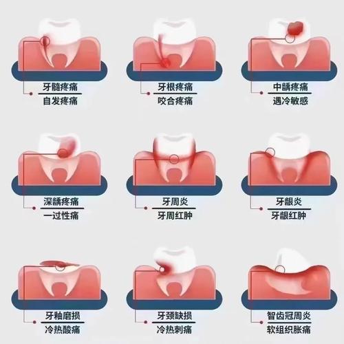 牙齿胀痛是什么原因