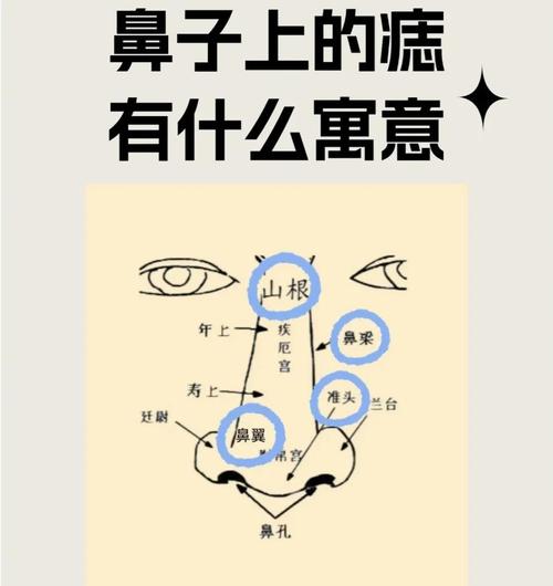 鼻梁上有痣代表什么