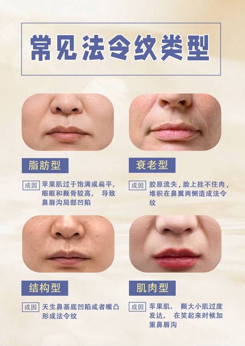 为什么会长法令纹