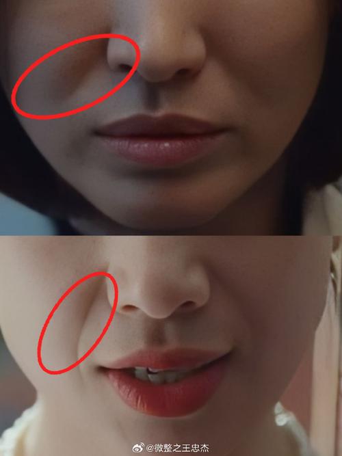 为什么会长法令纹