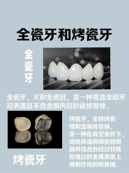 为什么要做烤瓷牙