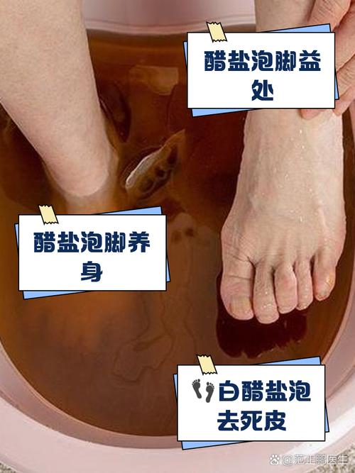 泡脚加醋有什么好处