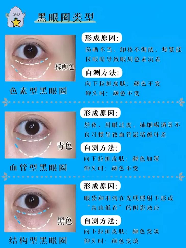 什么的黑眼圈