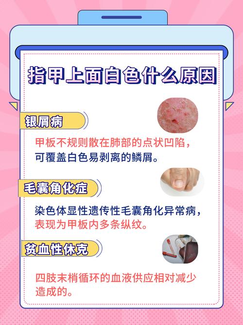 指甲白斑是什么原因