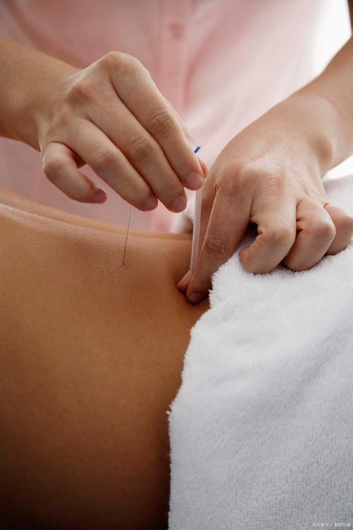 针灸减肥的科学依据是什么