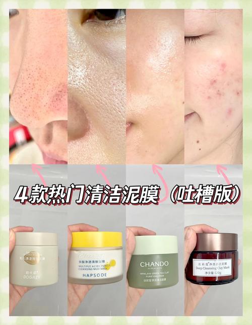 什么去黑头效果最好