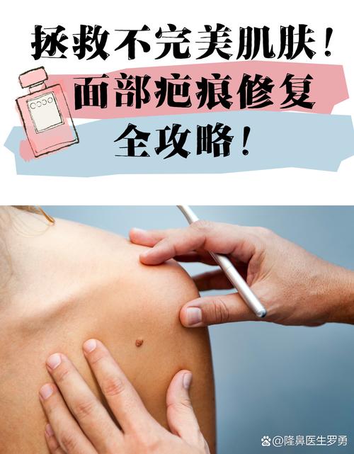 什么对疤痕修复