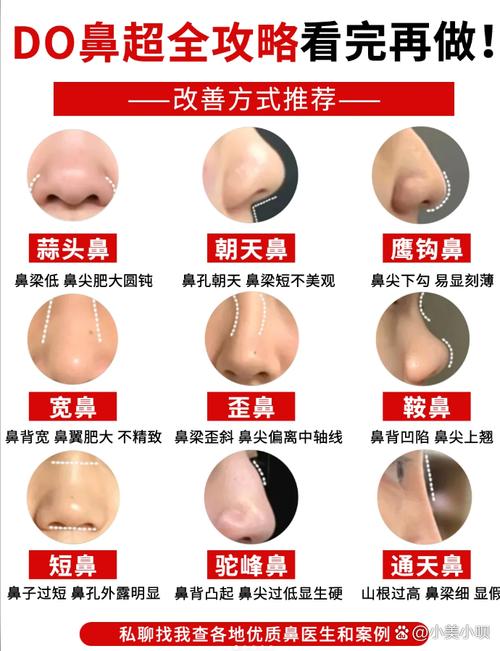 做鼻子什么材料好