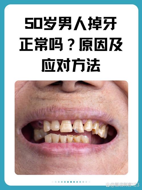 掉牙齿是什么病