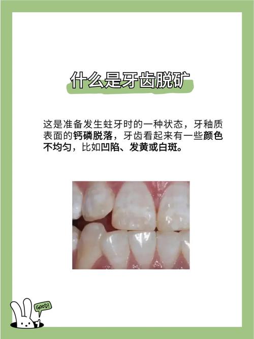 掉牙齿是什么病