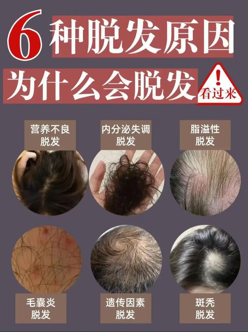 为什么减肥会掉头发