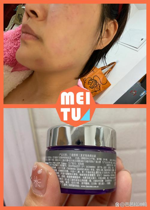 脸过敏用什么化妆品