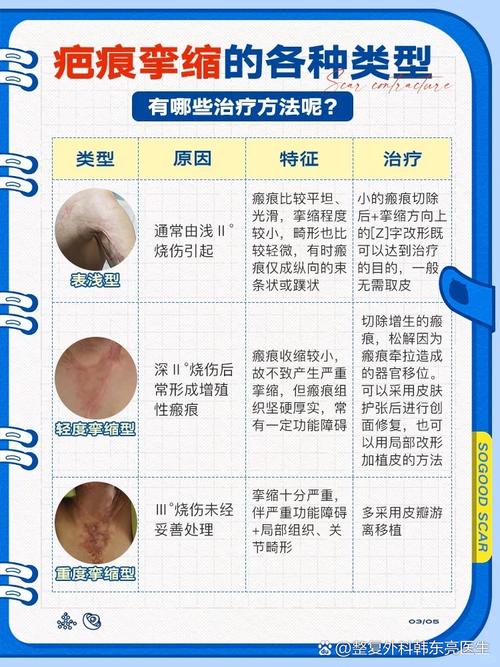 为什么会有疤痕增生