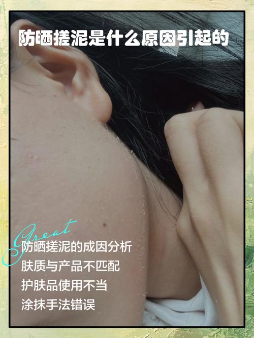 防晒霜为什么会搓泥