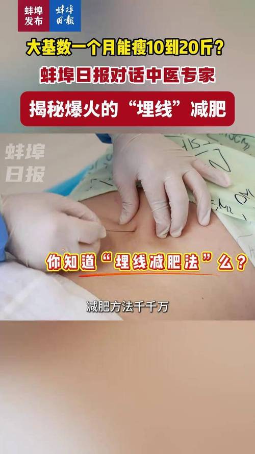 埋线减肥为什么不上大侧