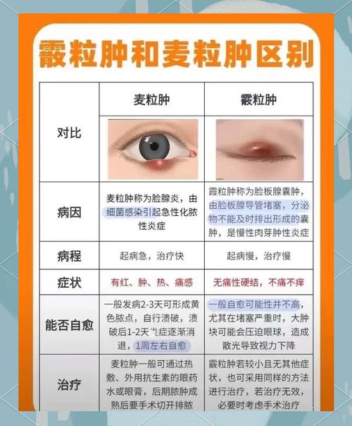 眼睑水肿是什么原因