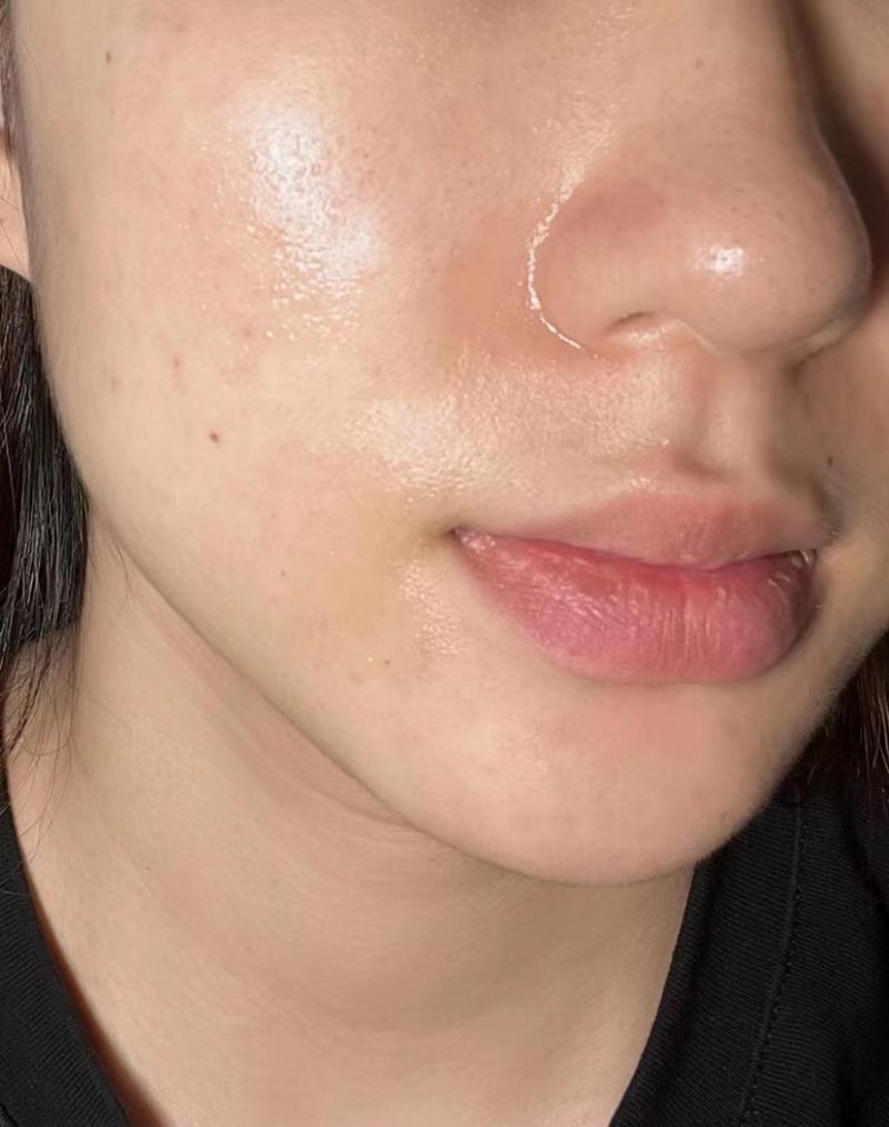 为什么脸上容易出油