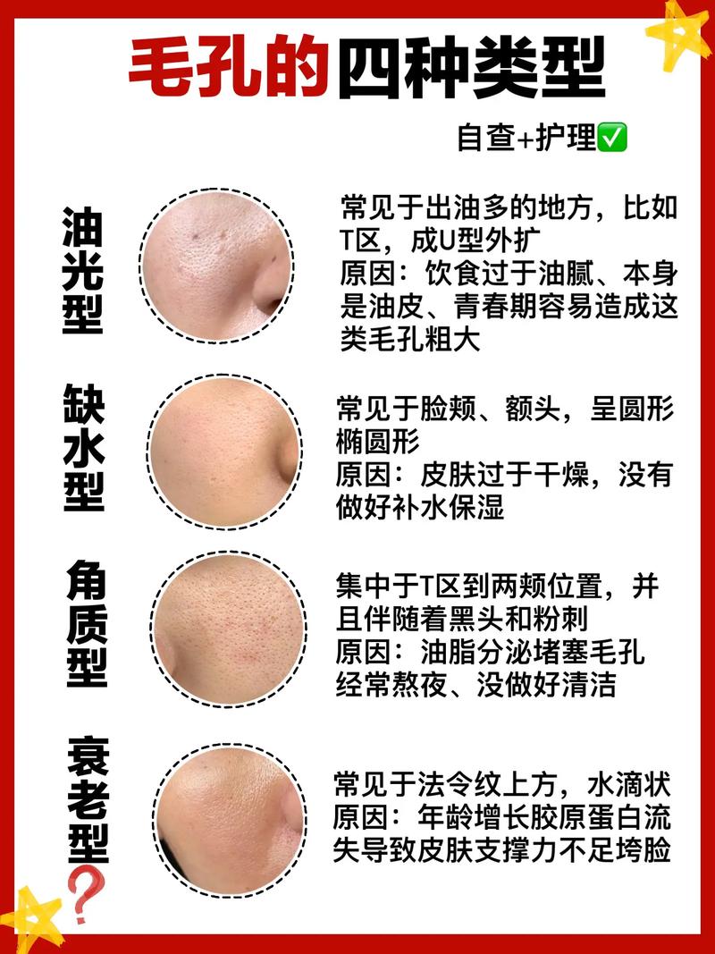 脸上为什么有毛孔