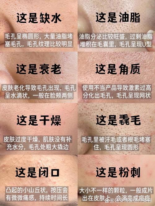 脸上为什么有毛孔