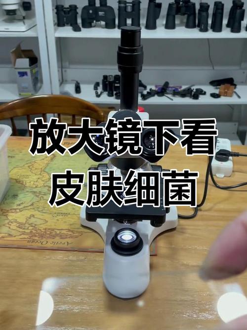 丙酸杆菌是什么