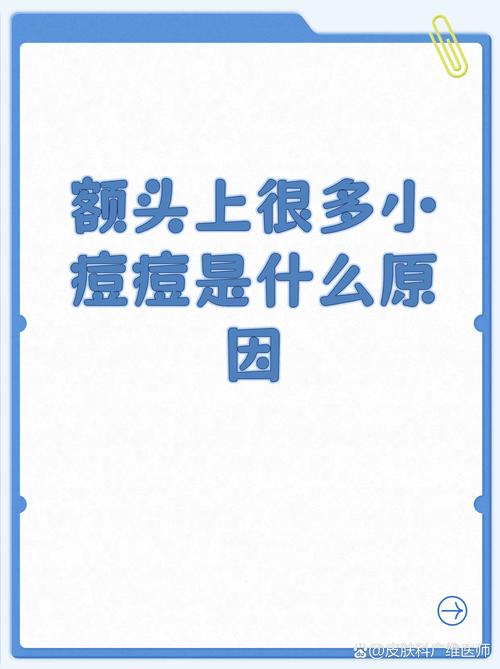 额头高是什么原因