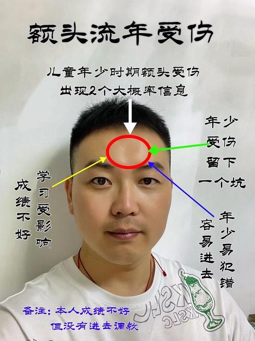 额头高是什么原因