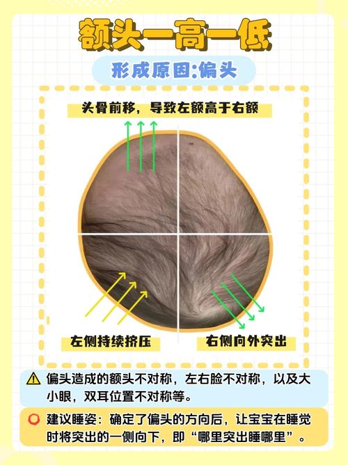 额头高是什么原因