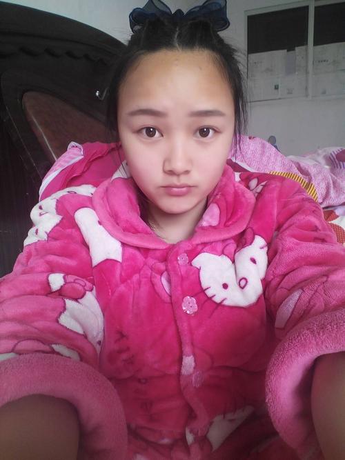 为什么额头比脸黑