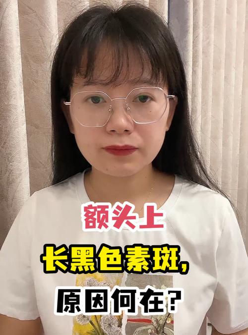 为什么额头比脸黑