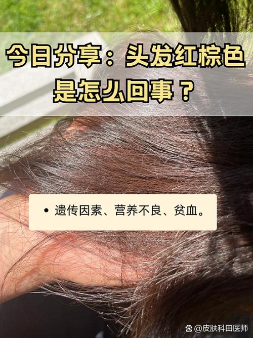 头发为什么会变红