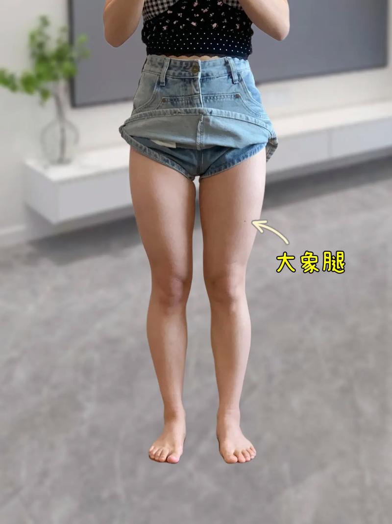 吃什么腿会变粗