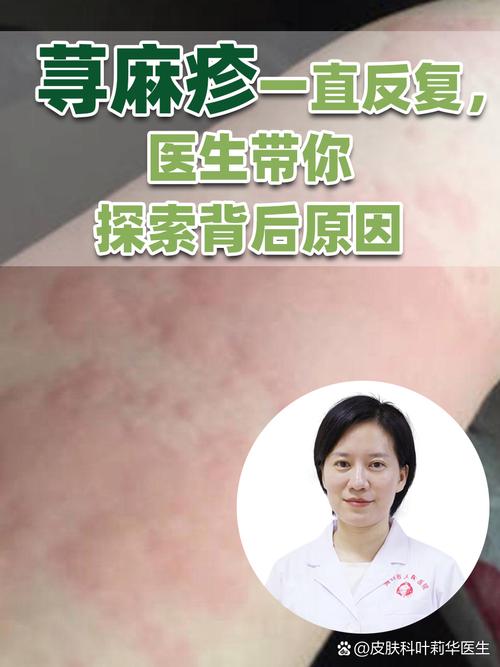 皮肤为什么老是过敏