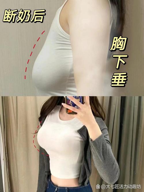 为什么胸部会下垂