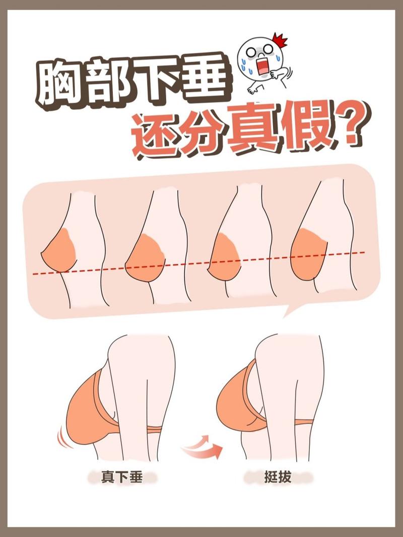 为什么胸部会下垂