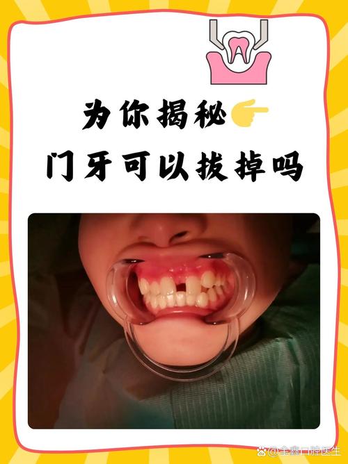 门牙有什么作用