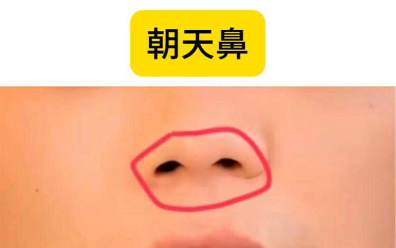 朝天鼻什么样