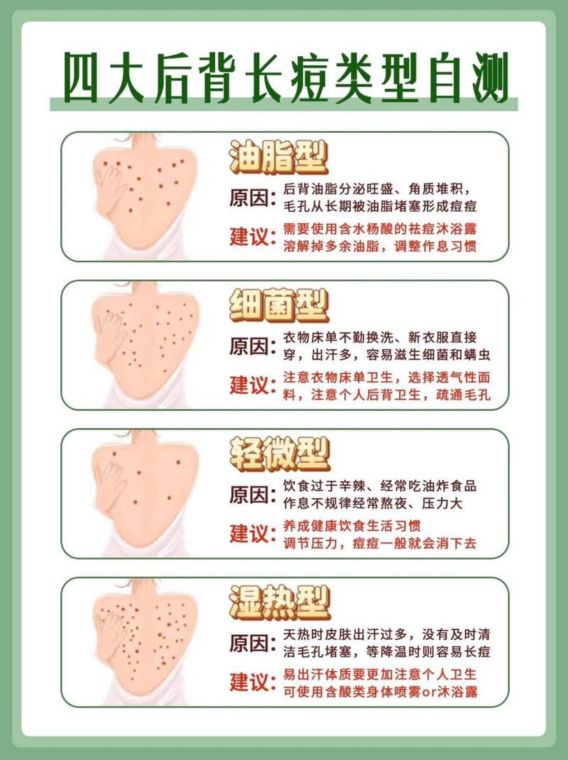 为什么背上会长痘