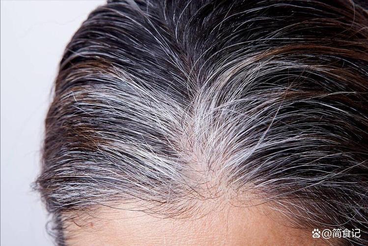 为什么这么多白头发