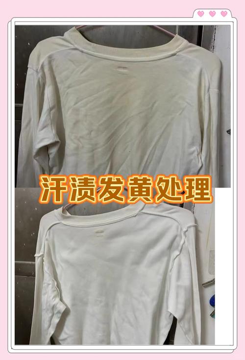 为什么白衣服会变黄