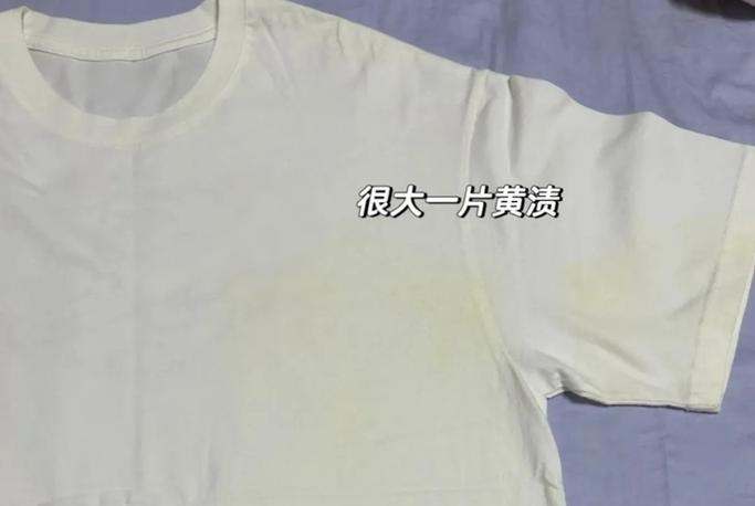 为什么白衣服会变黄