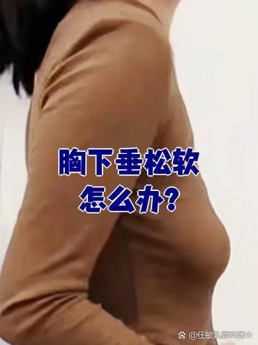 胸下垂是什么样