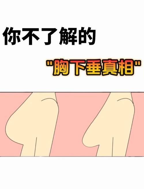 胸下垂是什么样