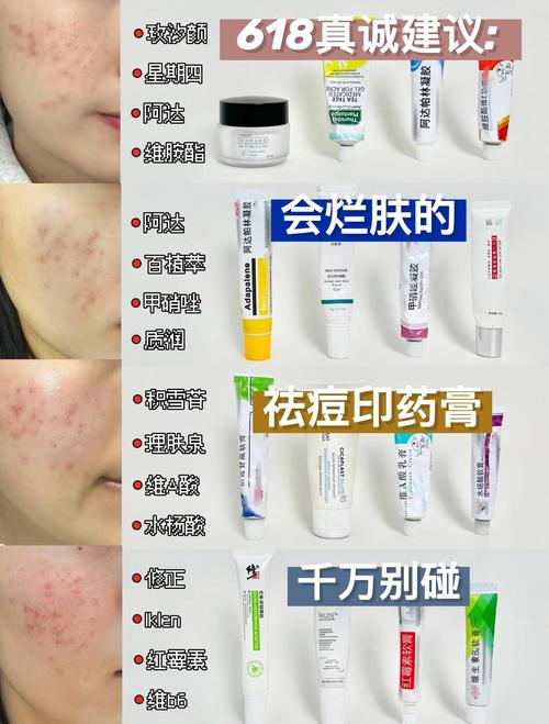 什么药膏可以祛痘印