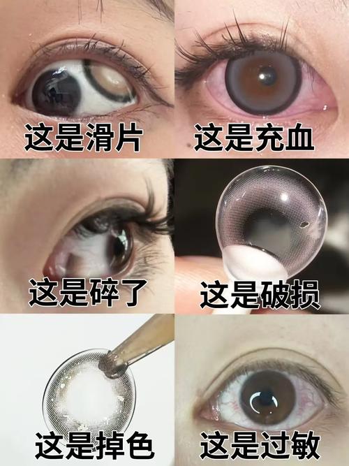 带美瞳有什么危害