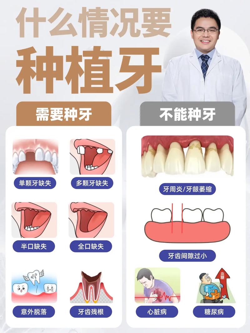 什么情况需要种牙
