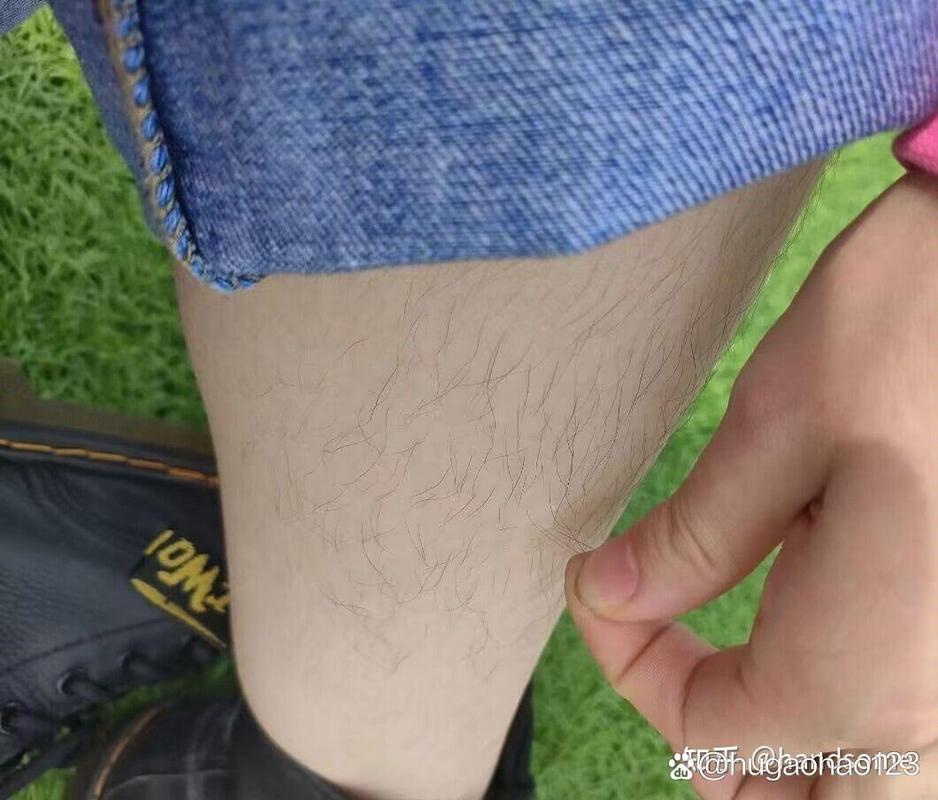 为什么女生会长腿毛