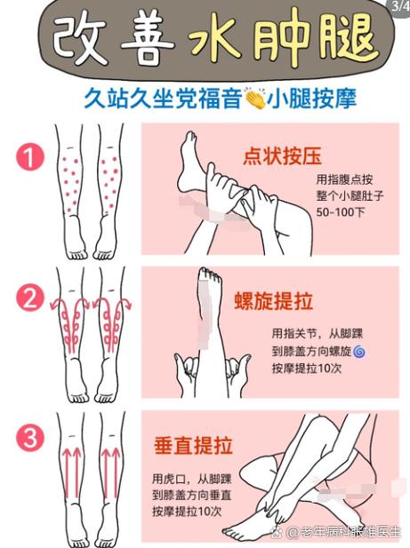 为什么小腿会水肿