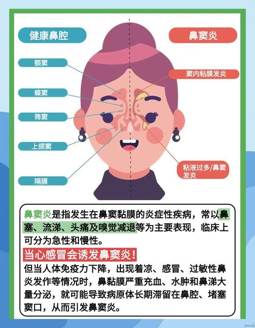 鼻塞头疼是什么感冒