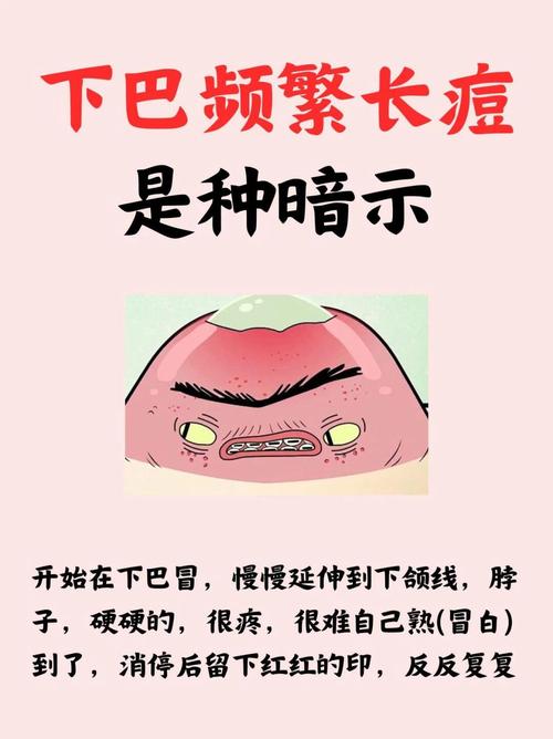 为什么下巴总长痘